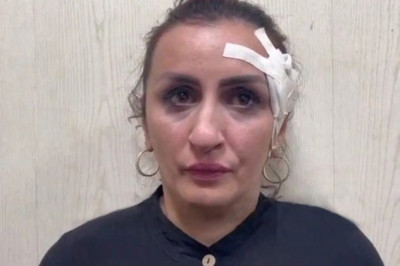 Mulher é presa após vender filho para pagar operação no nariz