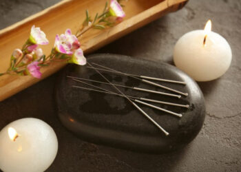 Conheça os benefícios da acupuntura para a saúde mental