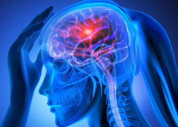 Conheça 7 hábitos para evitar AVC