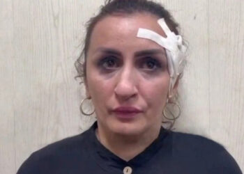 Mulher é presa após vender filho para pagar operação no nariz