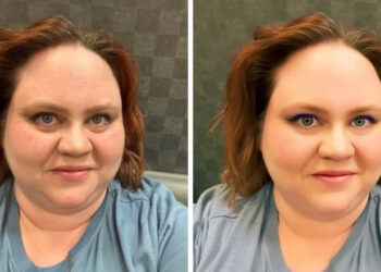 Entenda a regulação dos apps que retocam fotos